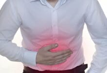 متلازمة القولون العصبي